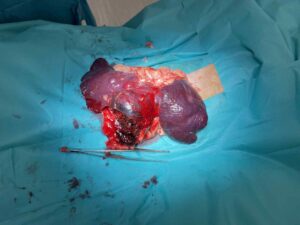 Chilli põrnakasvaja