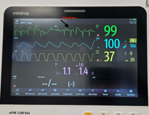 anesteesia monitooring